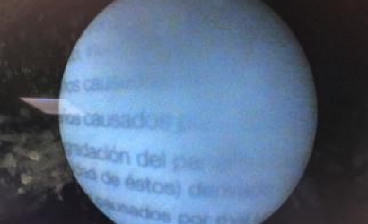 輸尿管鏡手術(shù)操作技巧的體會及R.Wolf輸尿管鏡的維修案例