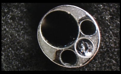 經(jīng)皮椎間孔鏡治療及提斯joimaxFS63421810椎間孔鏡的維修案例